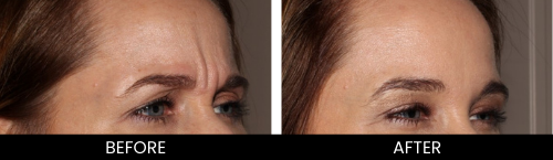 before-and-after-4-e1651003805419.png
